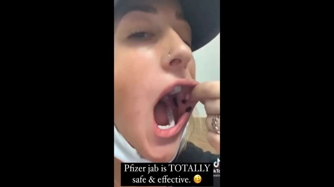 Vaxxed Woman Develops Huge Busted Blood Vessels Inside Mouth and On Body