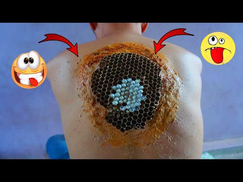 [ Wasp Nest Body ] Dandruff Scratching And Cleaning Worm #313